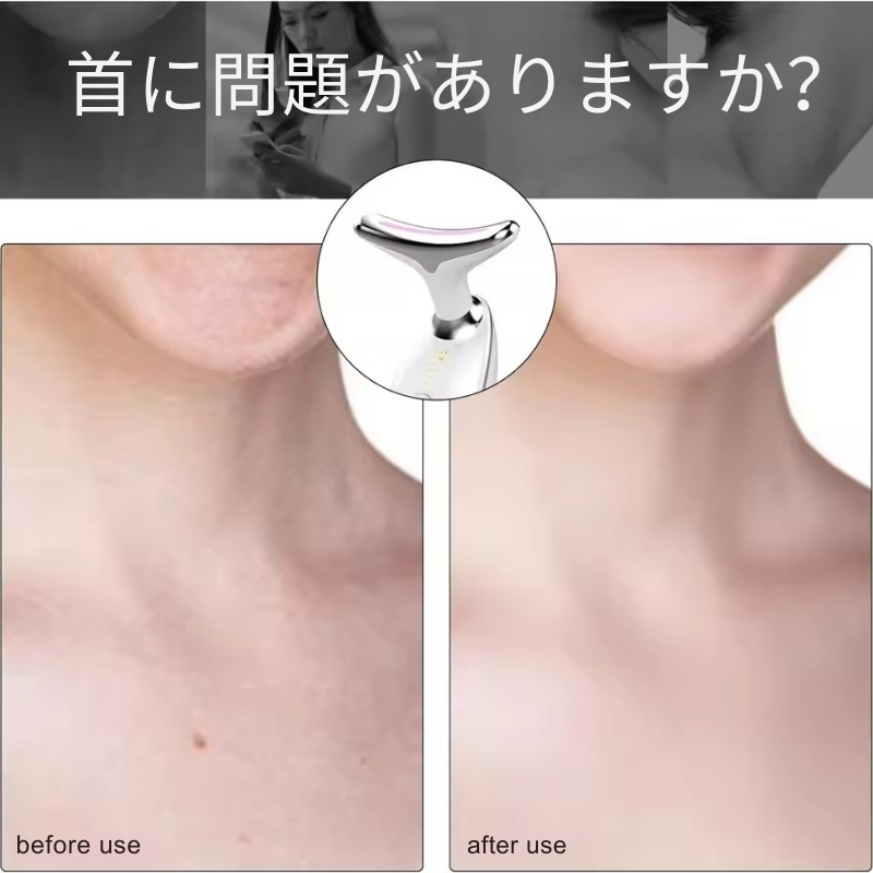 V-Face Glow™ EMSマッサージャ